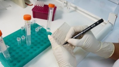 Pesquisadores da USP isolam variante ômicron do SARS-CoV-2