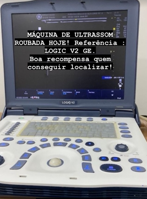 Aparelho de ultrassom é furtado de carro do vice-prefeito de Elesbão Veloso