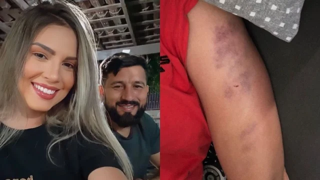 Namorada acusa empresário de tentativa de feminicídio no Piauí
