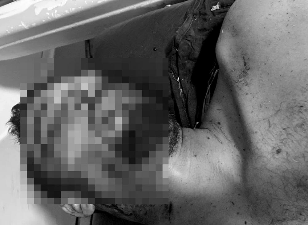 Suspeito de manter namorada em cárcere privado é espancado e alvejado com tiro na cabeça no Piauí