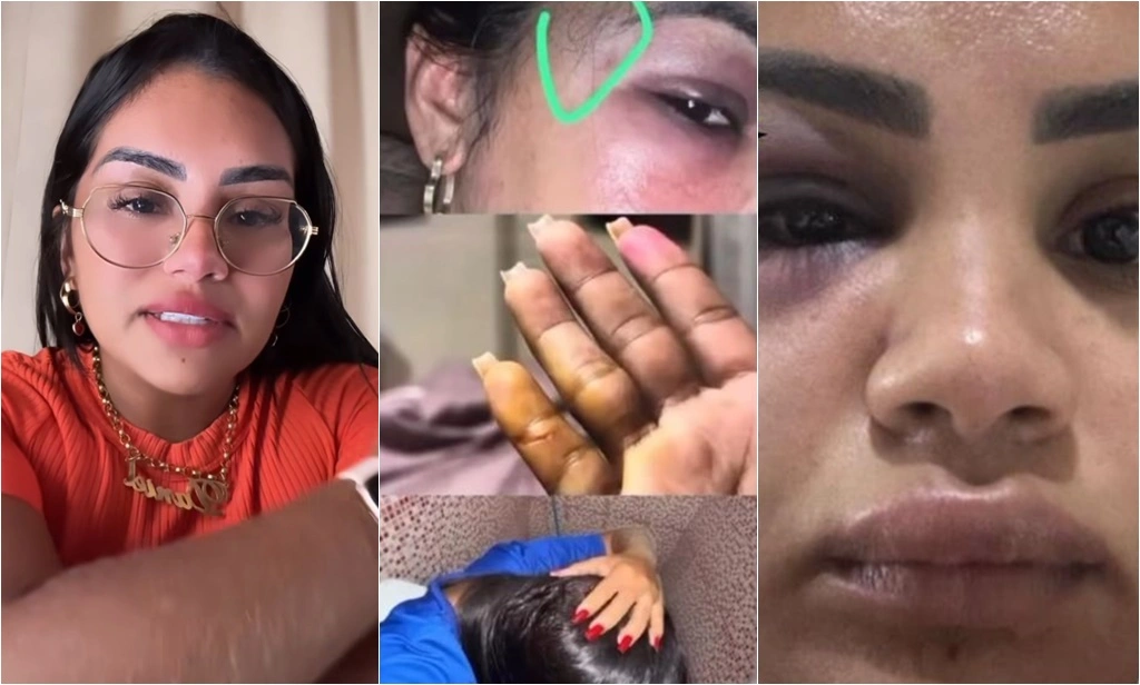 Ex-mulher de Chicão dos Teclados, influencer denuncia agressões do namorado