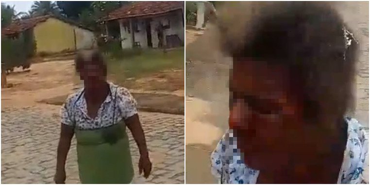 Filha é presa acusada de queimar o rosto da própria mãe com água quente