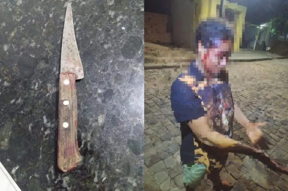 Mulher é gravemente ferida na cabeça ao ser espancada por companheiro no Piauí