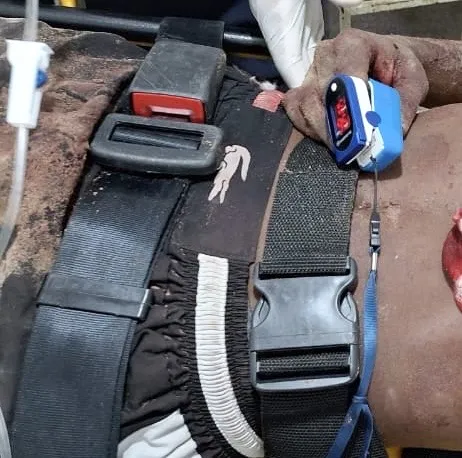 Jovem de 20 anos é baleado durante tentativa de homicídio em Regeneração