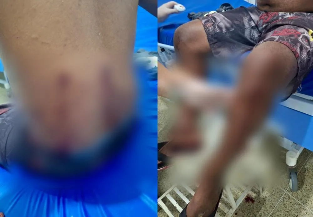 Homem é baleado com quatro tiros durante tentativa de homicídio em São Pedro do Piauí
