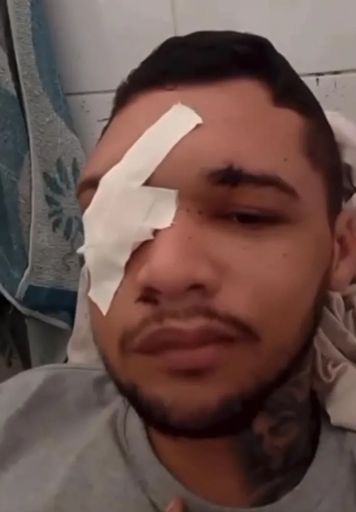 Jovem sobrevive após levar dois tiros na cabeça por engano em Teresina